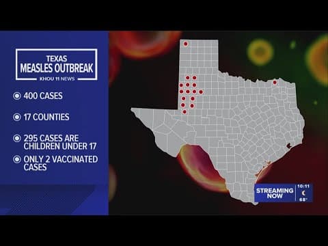 400 people in Texas included in measles outbreak