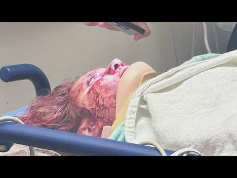 Suspect wanted for attacking Oklahoma woman on bachelorette trip arrested in Bedford, police say