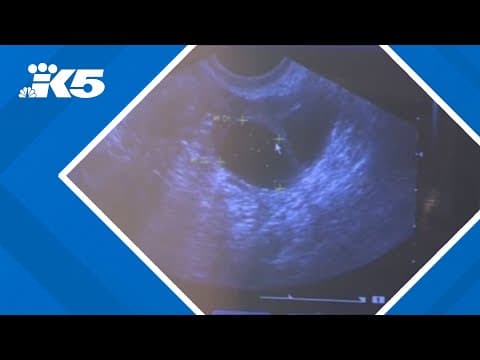 Gov. Jay Inslee directive affirms patients' rights to abortion