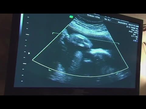 Abortion-rights amendment cleared for Ohio’s November ballot, promising expensive fight this fall