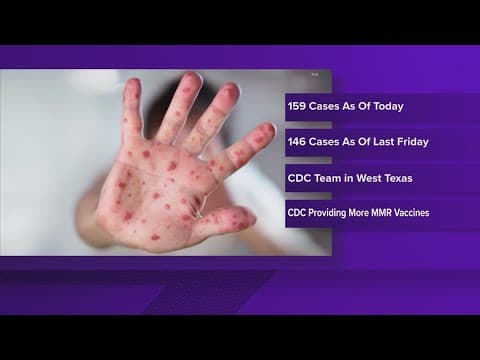 Texas now reporting 159 measles cases across the state