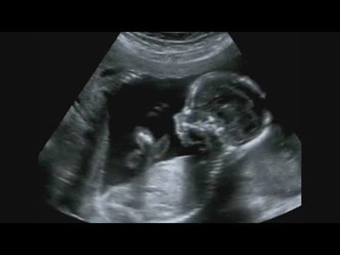 YouTube thumbnail for video 2PeSOkaUFXw