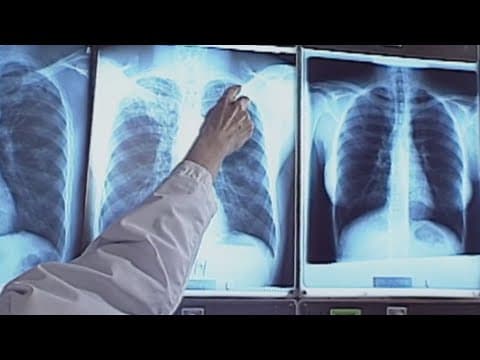 2 dead and nearly 60 infected with Legionnaire's disease in Harlem New York