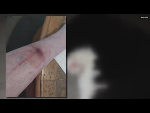 Man says he was attacked by the same dogs that killed man on east side