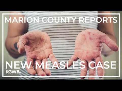 Marion County reports eighth measles case since June
