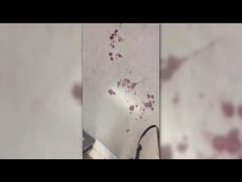 More complaints against BLVD63 apartment near SDSU