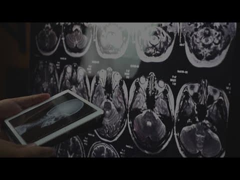 Houston researchers lead national study showing lifestyle changes may slow dementia