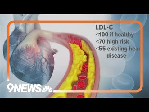 Your cholesterol: Medical expert explains what you should be looking out for