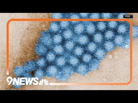 Stomach bug causing sudden vomiting, diarrhea surges in US