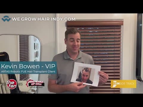 Multi-Unit Hair Grafting and Artas Robotic FUE at We Grow Hair Indy