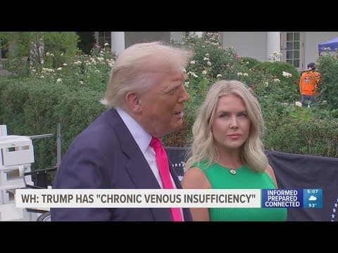 President Trump has health exam for chronic venous insufficiency