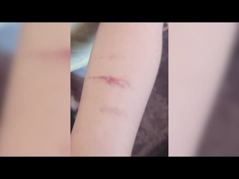 North Texas teacher fired, arrested after being charged with hurting student