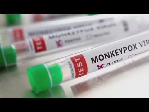 Ohio reports first death associated with monkeypox