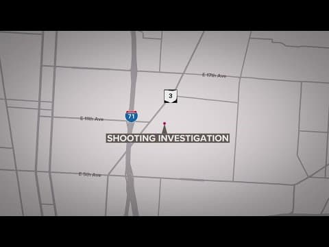 17-year-old injured in South Linden shooting