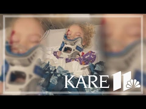 3-year-old recovering after hit-and-run in northeast Minneapolis