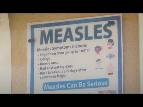 Person infected with measles dies in New Mexico