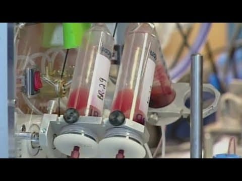 FDA may approve blood test to detect colon cancer