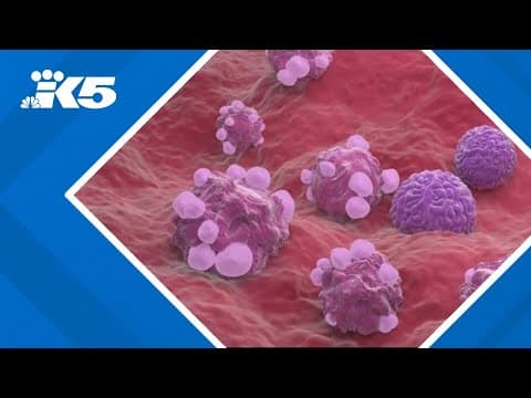 Endometriosis link to ovarian cancer