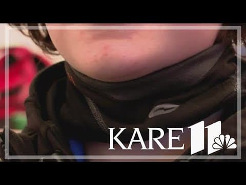 YouTube thumbnail for video C2aR2oepy3U