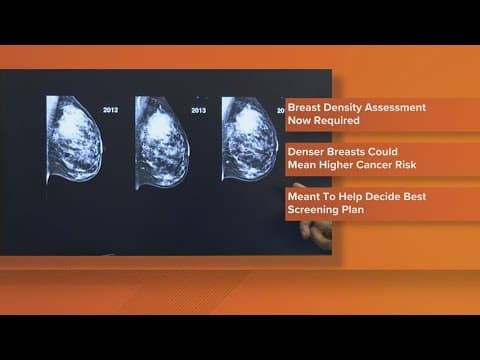 Breast cancer may now be caught quicker by doctors with new requirements