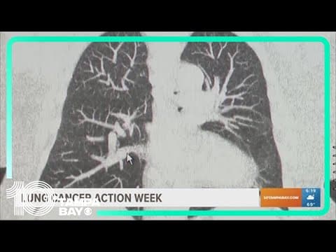 Florida has the highest death, new case rate for lung cancer