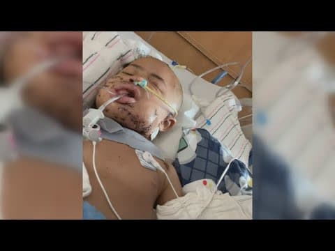 South Bend first responders save boy after dog attack | Inspiring Indiana
