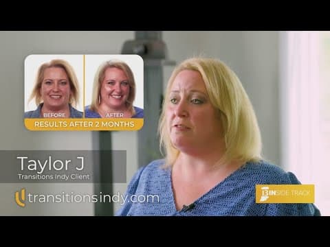 Taylor’s transformation: Overcoming hair loss with Transitions Indy