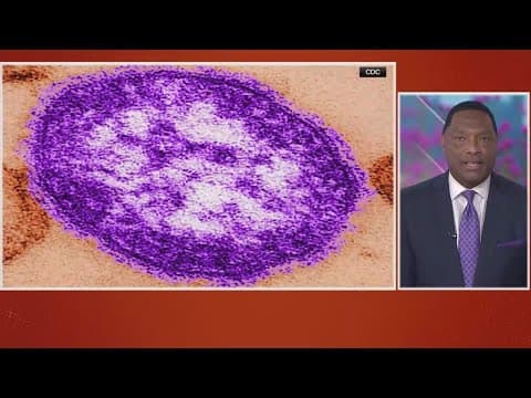 Another child has died from measles in Texas