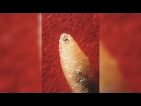 Maryland resident is diagnosed with the first U.S. human case of screwworm