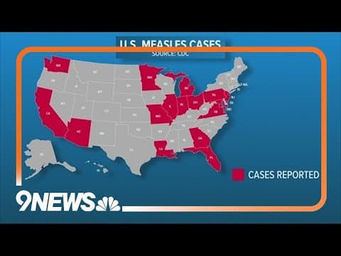 Measles cases on the rise in the U.S.