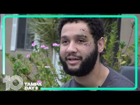 Hit-and-run survivor searches for answers as he makes small steps toward recovery