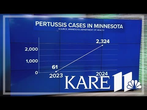 Minnesota reports huge increase in whooping cough cases