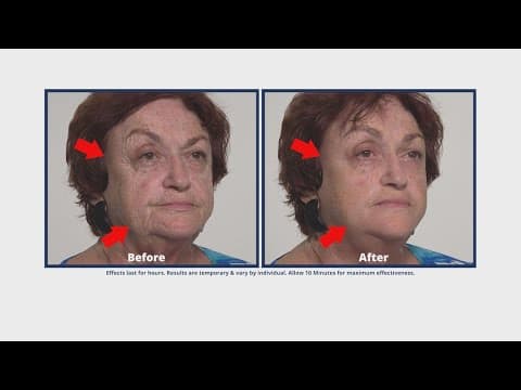 Plexaderm is offering a holiday special!