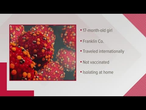 Ohio's 1st case of measles since 2019 confirmed in Franklin County 17-month-old