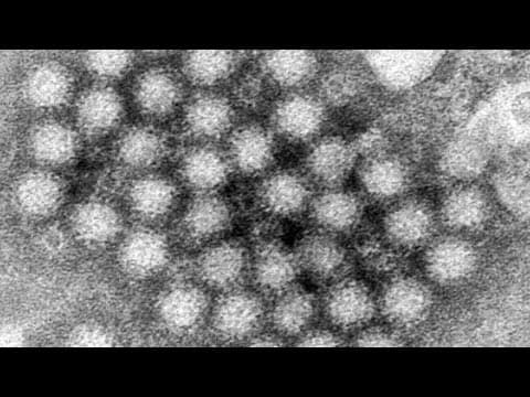 Central Indiana is facing a surge in viruses