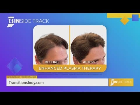 Regain confidence with hair restoration at Transitions Indy