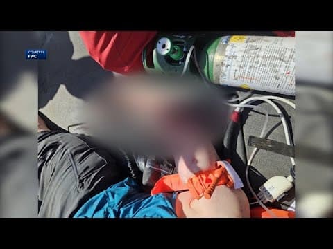 Texas woman nearly loses arm in alligator attack while kayaking on vacation