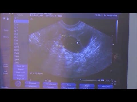 Texas Supreme Court rejects challenge to abortion laws