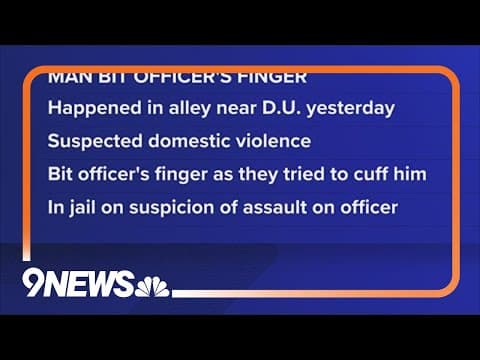 Man bites off part of officer's finger during arrest, police say