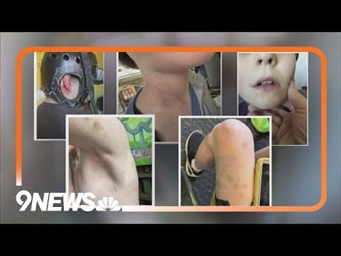 Federal investigation launched into bus aide who was caught abusing children with special needs