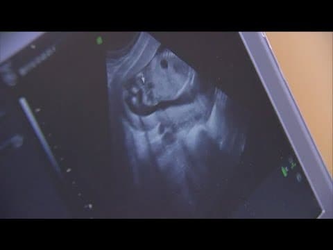 Supreme Court allows emergency abortions in Idaho after decision posted a day early