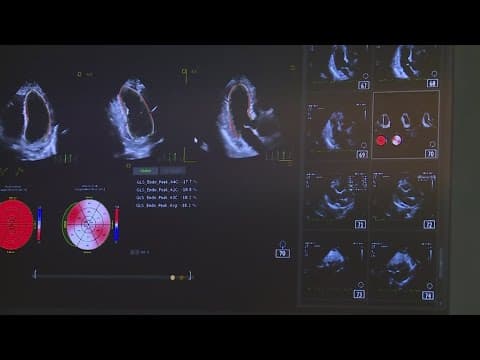 Doctors using AI to detective health problems