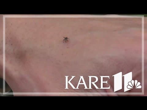 Experts say the long and snowy winter won't help us this tick season