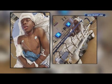 Shooter of Ralph Yarl dies just days after entering guilty plea