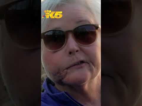 Survivor, friends who fought cougar describe cougar attack near Snoqualmie