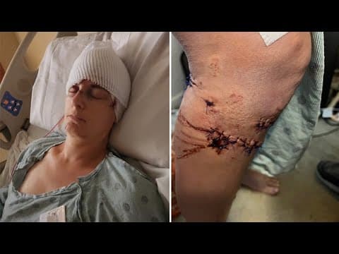 'They tried to eat me alive!' Houston-area woman says neighbor's 4 dogs attacked her