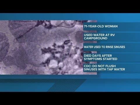 Texas woman dies after using water at RV campground to rinse sinuses