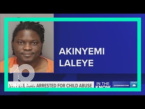 St. Pete man accused of child abuse, leaving 8-year-old permanently disfigured