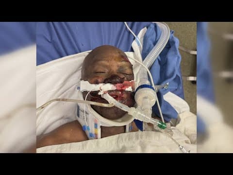 ‘We won’t rest’ | Family seeks justice after alleged police beating in Hammond