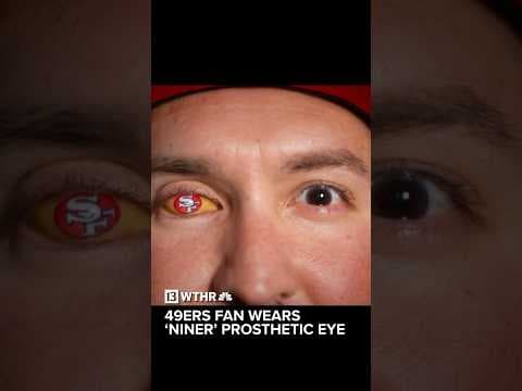 49ers fan wears 'Niner' prosthetic eye